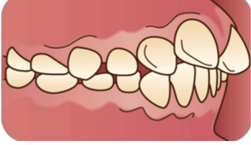 丁寧な説明をする院長/歯科医師の村田紗也子