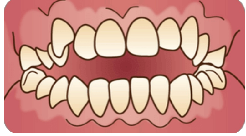 丁寧な説明をする院長/歯科医師の村田紗也子