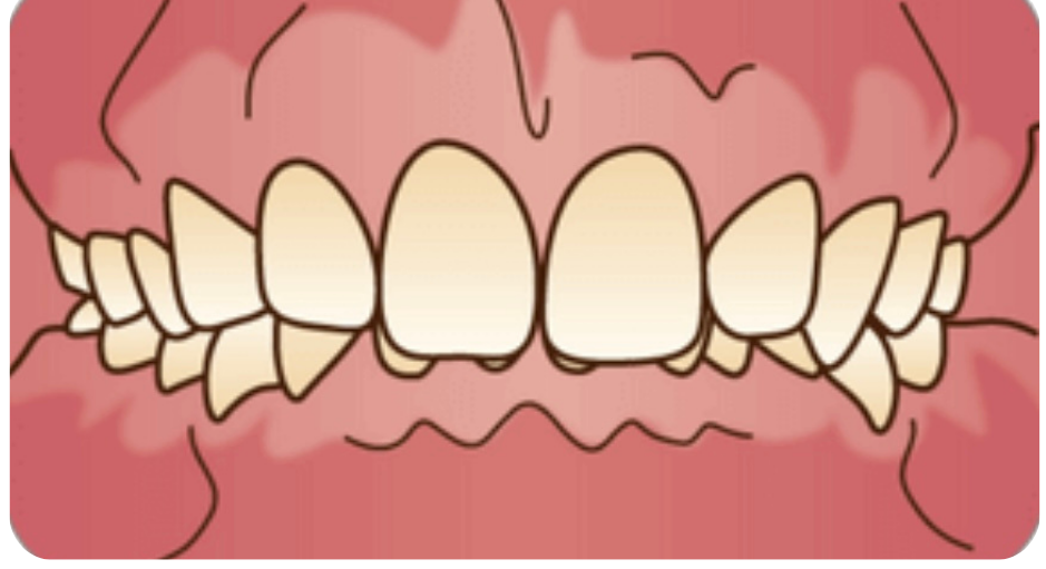 丁寧な説明をする院長/歯科医師の村田紗也子