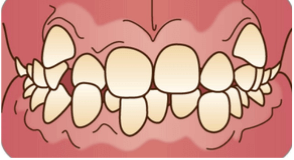 丁寧な説明をする院長/歯科医師の村田紗也子